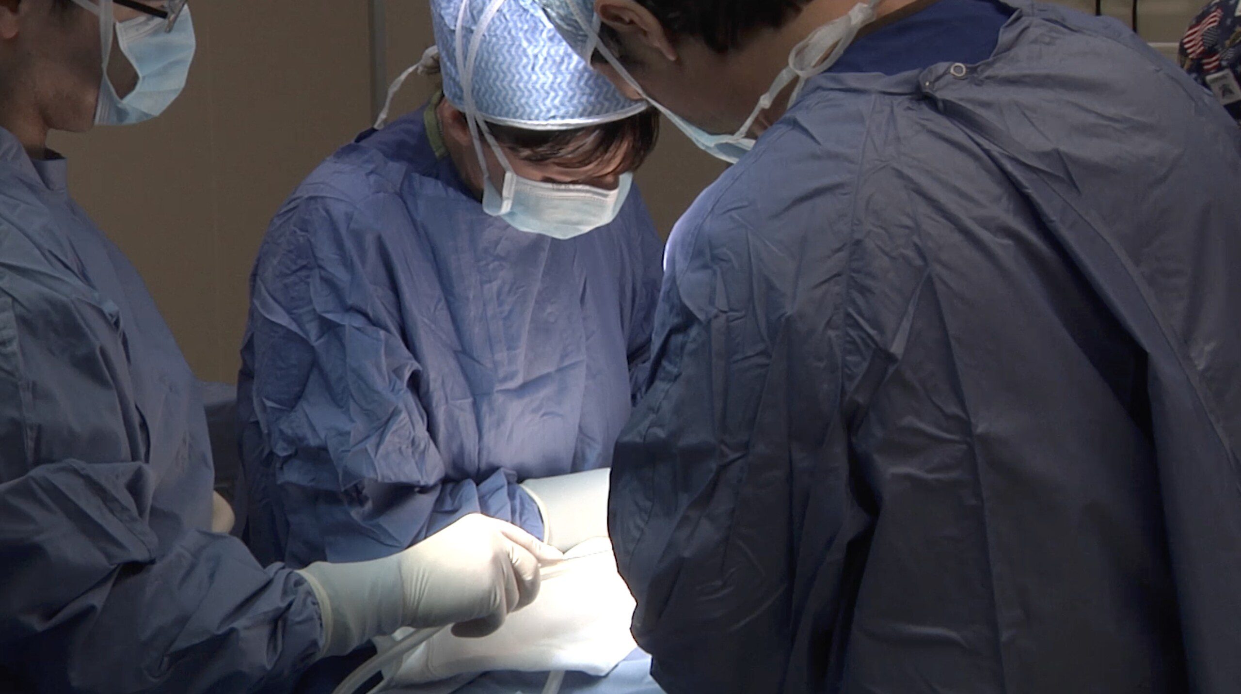 neonato vibonati fratture ospedale santobono