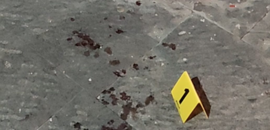 sparatoria pozzuoli padre figlio feriti