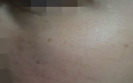 borrelli picchiato strada padre bullo