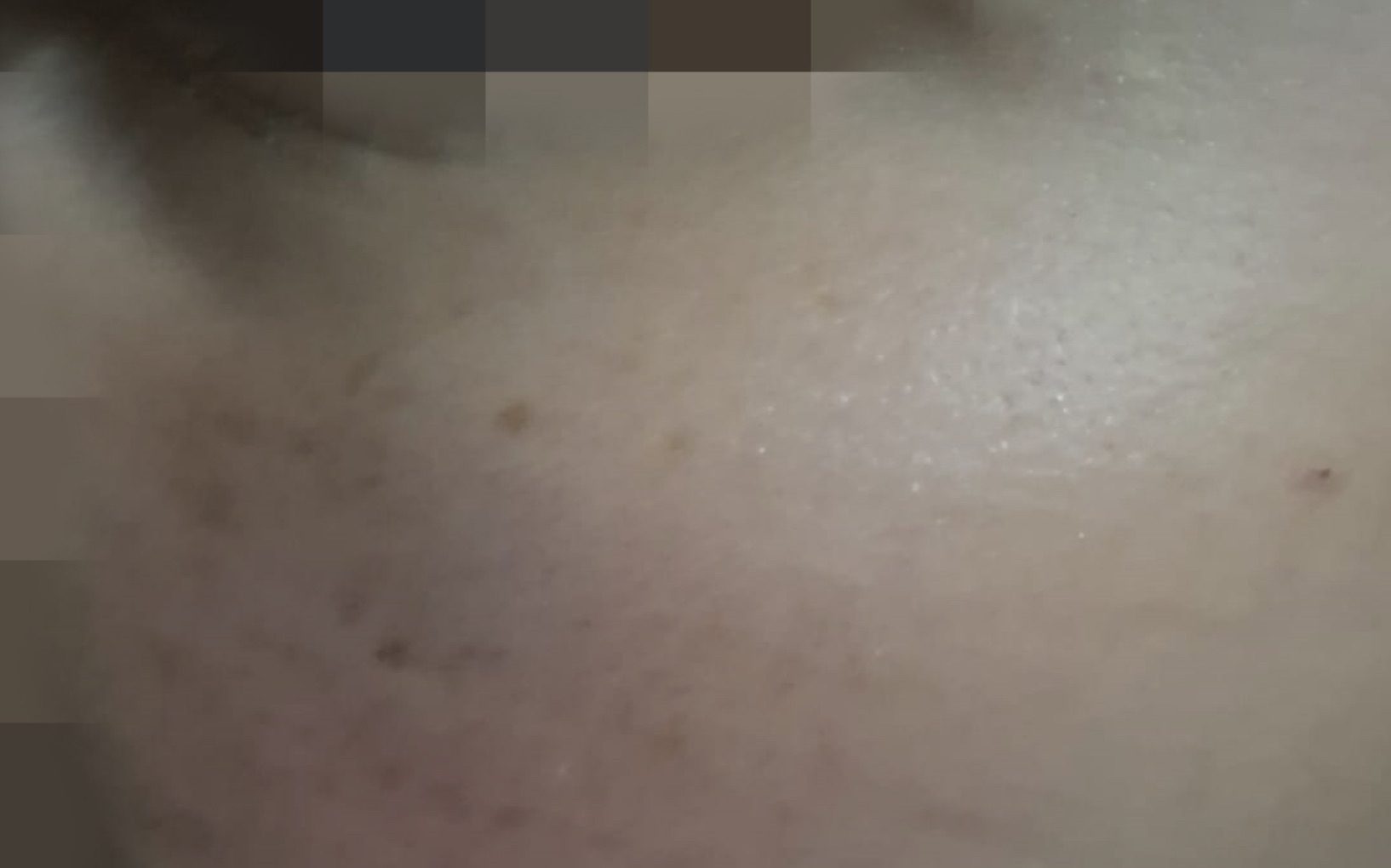 borrelli picchiato strada padre bullo