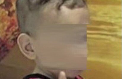 Bollettino medico trapianto bimbo