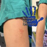 aggressione pronto soccorso nessuno tocchi ippocrate ospedale del mare