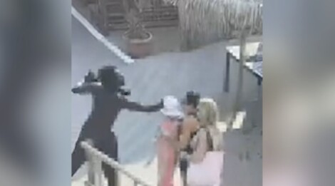 schiaffo cliente lido aggressione video castel volturno